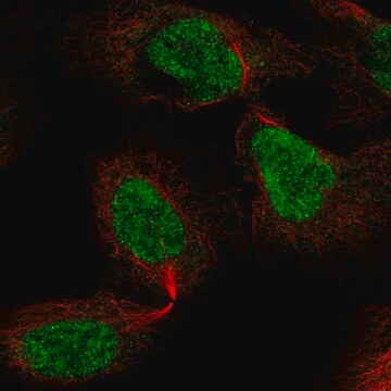 Anti-Znf496 Antibody Produced In Rabbit Prestige Antibodies&#174; Powered by Atlas Antibodies, affinity isolated antibody, buffered aqueous glycerol solution