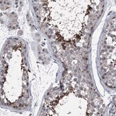 Anti-CEP85L antibody produced in rabbit Prestige Antibodies® Powered by Atlas Antibodies, affinity isolated antibody, buffered aqueous glycerol solution, ab3