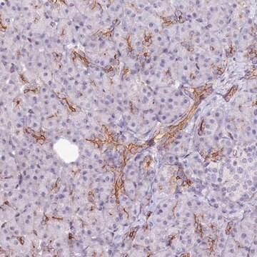 Anti-ST7 antibody produced in rabbit Prestige Antibodies&#174; Powered by Atlas Antibodies, affinity isolated antibody, buffered aqueous glycerol solution