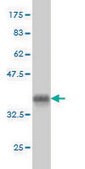 ANTI-SGK antibody produced in mouse clone 3C4, purified immunoglobulin, buffered aqueous solution