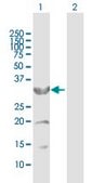 Anti-CYB5R3 antibody produced in mouse purified immunoglobulin, buffered aqueous solution