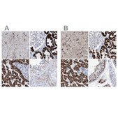 Anti-ALDH6A1 antibody produced in rabbit Prestige Antibodies® Powered by Atlas Antibodies, affinity isolated antibody, buffered aqueous glycerol solution, ab2