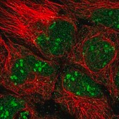Anti-DPH6 antibody produced in rabbit Prestige Antibodies® Powered by Atlas Antibodies, affinity isolated antibody, buffered aqueous glycerol solution
