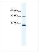 Anti-APOBEC3G antibody produced in rabbit affinity isolated antibody