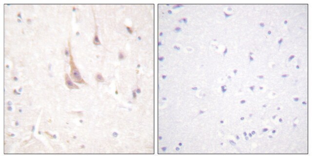 Anti-PKC &#950; antibody produced in rabbit affinity isolated antibody
