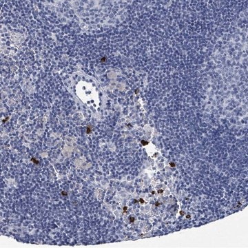 Anti-VPS13D antibody produced in rabbit Prestige Antibodies® Powered by Atlas Antibodies, affinity isolated antibody, buffered aqueous glycerol solution