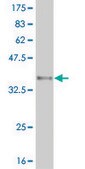 Monoclonal Anti-ARID1B antibody produced in mouse clone 2F2, purified immunoglobulin, buffered aqueous solution