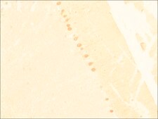 抗-钙结合蛋白-D-28K (KD-15) 兔抗 affinity isolated antibody, buffered aqueous solution