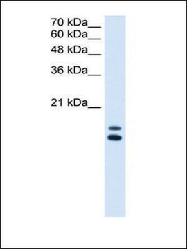 Anti-UXT (AB2) antibody produced in rabbit IgG fraction of antiserum