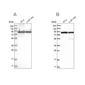 Anti-DDX1 antibody produced in rabbit Prestige Antibodies&#174; Powered by Atlas Antibodies, affinity isolated antibody, buffered aqueous glycerol solution