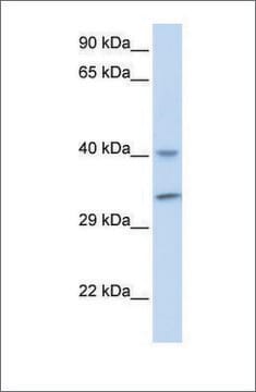 Anti-ALKBH3 antibody produced in rabbit affinity isolated antibody