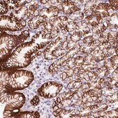 Anti-CYB561A3 antibody produced in rabbit Prestige Antibodies&#174; Powered by Atlas Antibodies, affinity isolated antibody, buffered aqueous glycerol solution