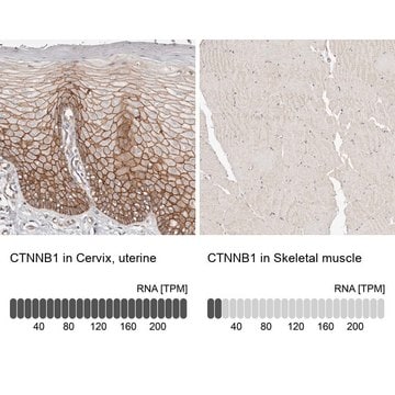 Anti-CTNNB1 antibody produced in rabbit Prestige Antibodies&#174; Powered by Atlas Antibodies, affinity isolated antibody, buffered aqueous glycerol solution