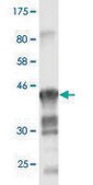 Monoclonal Anti-CLDN1 antibody produced in mouse clone 2E2-H5, purified immunoglobulin, buffered aqueous solution