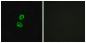 Anti-FGF22 antibody produced in rabbit affinity isolated antibody