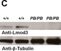 Anti-LMOD3 antibody produced in rabbit Prestige Antibodies® Powered by Atlas Antibodies, affinity isolated antibody, buffered aqueous glycerol solution