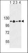 ANTI-COL17A1 (CENTER) antibody produced in rabbit IgG fraction of antiserum, buffered aqueous solution