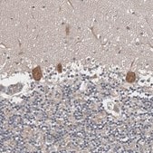 Anti-CHML antibody produced in rabbit Prestige Antibodies&#174; Powered by Atlas Antibodies, affinity isolated antibody, buffered aqueous glycerol solution