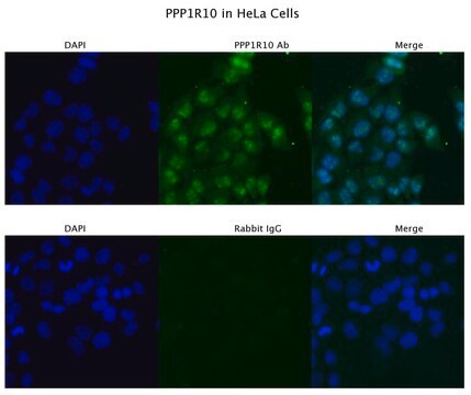 Anti-PPP1R10 antibody produced in rabbit affinity isolated antibody