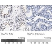 Anti-AKAP4 antibody produced in rabbit Prestige Antibodies® Powered by Atlas Antibodies, affinity isolated antibody, buffered aqueous glycerol solution