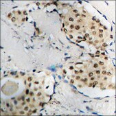 Anti-phospho-B-RAF (pSer446) antibody produced in rabbit affinity isolated antibody