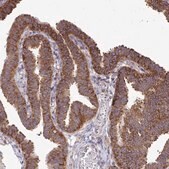 Anti-FMR1 antibody produced in rabbit Prestige Antibodies&#174; Powered by Atlas Antibodies, affinity isolated antibody, buffered aqueous glycerol solution