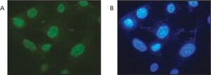 Anti-MTA2/MTA1L1 (RT-16) antibody produced in rabbit IgG fraction of antiserum, buffered aqueous solution