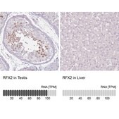 Anti-RFX2 antibody produced in rabbit Prestige Antibodies® Powered by Atlas Antibodies, affinity isolated antibody, buffered aqueous glycerol solution