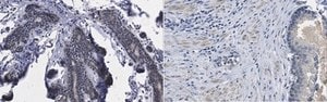 Anti-CXCR-4 from rabbit, purified by affinity chromatography
