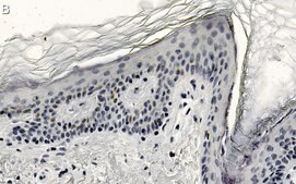 Anti-CBX2 Antibody, clone 3I14 ZooMAb&#174; Rabbit Monoclonal recombinant, expressed in HEK 293 cells
