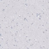 Monoclonal Anti-MS4A1 antibody produced in mouse Prestige Antibodies® Powered by Atlas Antibodies, clone CL10613, purified antibody (Protein A)