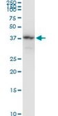Monoclonal Anti-NAGK antibody produced in mouse clone 1H8, purified immunoglobulin, buffered aqueous solution