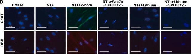 Anti-Choline Acetyltransferase Antibody, clone 1E6 ascites fluid, clone 1E6, Chemicon&#174;