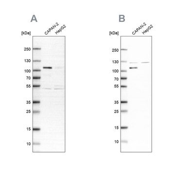 Anti-SP1 antibody produced in rabbit Ab1, Prestige Antibodies&#174; Powered by Atlas Antibodies, affinity isolated antibody, buffered aqueous glycerol solution