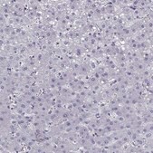 Anti-PTH antibody produced in rabbit Prestige Antibodies&#174; Powered by Atlas Antibodies, affinity isolated antibody