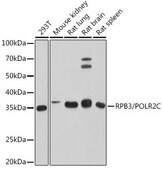 Anti-RPB3/POLR2C Antibody, clone 3T8K8, Rabbit Monoclonal
