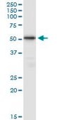 Anti-TUBB4Q antibody produced in mouse IgG fraction of antiserum, buffered aqueous solution