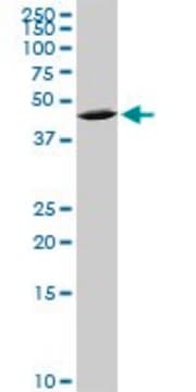 Anti-QPCT antibody produced in mouse purified immunoglobulin, buffered aqueous solution