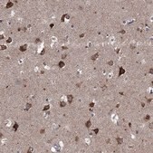 Anti-SLC2A13 antibody produced in rabbit Prestige Antibodies&#174; Powered by Atlas Antibodies, affinity isolated antibody, buffered aqueous glycerol solution