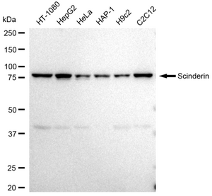 Anti Scinderin Antibody, clone 23GB4135, Rabbit Monoclonal clone 23GB4135, recombinant rabbit monoclonal, expressed in HEK293 cells