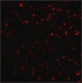 Anti-BIK antibody produced in rabbit affinity isolated antibody, buffered aqueous solution