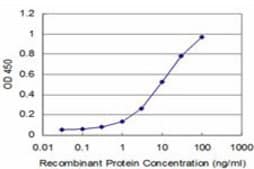 Monoclonal Anti-ROR2 antibody produced in mouse clone 4E1, purified immunoglobulin, buffered aqueous solution