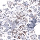 Anti-L1CAM antibody produced in mouse Prestige Antibodies® Powered by Atlas Antibodies, clone CL12984, purified by using Protein A, buffered aqueous glycerol solution