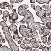 Anti-CMPK2 antibody produced in rabbit Prestige Antibodies® Powered by Atlas Antibodies, affinity isolated antibody, buffered aqueous glycerol solution