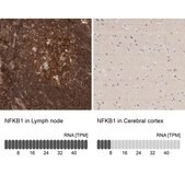 Anti-NFKB1 antibody produced in rabbit Prestige Antibodies® Powered by Atlas Antibodies, affinity isolated antibody, buffered aqueous glycerol solution