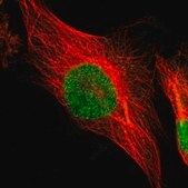 Anti-PSMC4 antibody produced in rabbit Ab1, Prestige Antibodies&#174; Powered by Atlas Antibodies, affinity isolated antibody, buffered aqueous glycerol solution