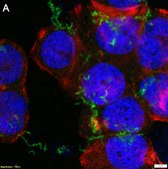 Anti-ROR2 clone XBR2-401 ZooMAb® Rabbit Monoclonal recombinant, expressed in HEK 293 cells