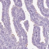 Anti-DNAH11 antibody produced in rabbit Prestige Antibodies&#174; Powered by Atlas Antibodies, affinity isolated antibody