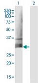Anti-CLEC5A antibody produced in mouse IgG fraction of antiserum, buffered aqueous solution