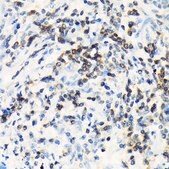 Anti-CSK antibody produced in rabbit